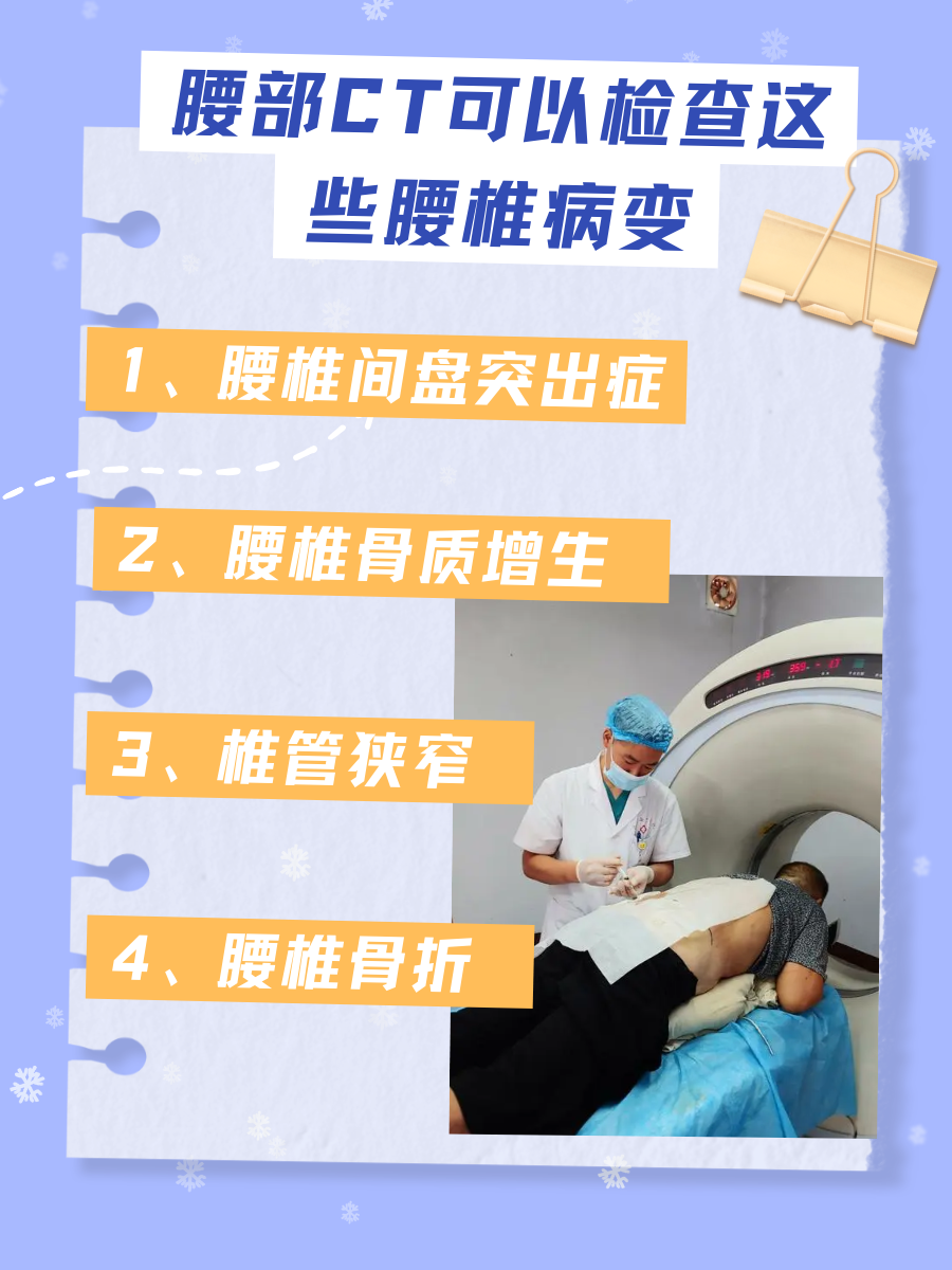 腰部CT是啥？做的时候要注意这些哦！