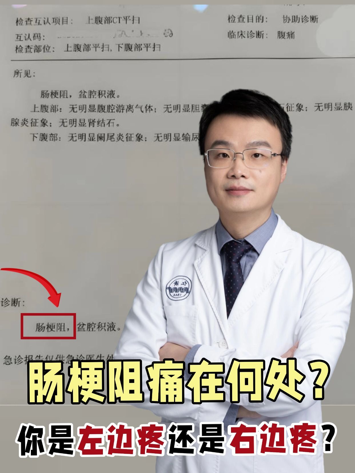 肠梗阻痛在何处？你是左边疼还是右边疼？