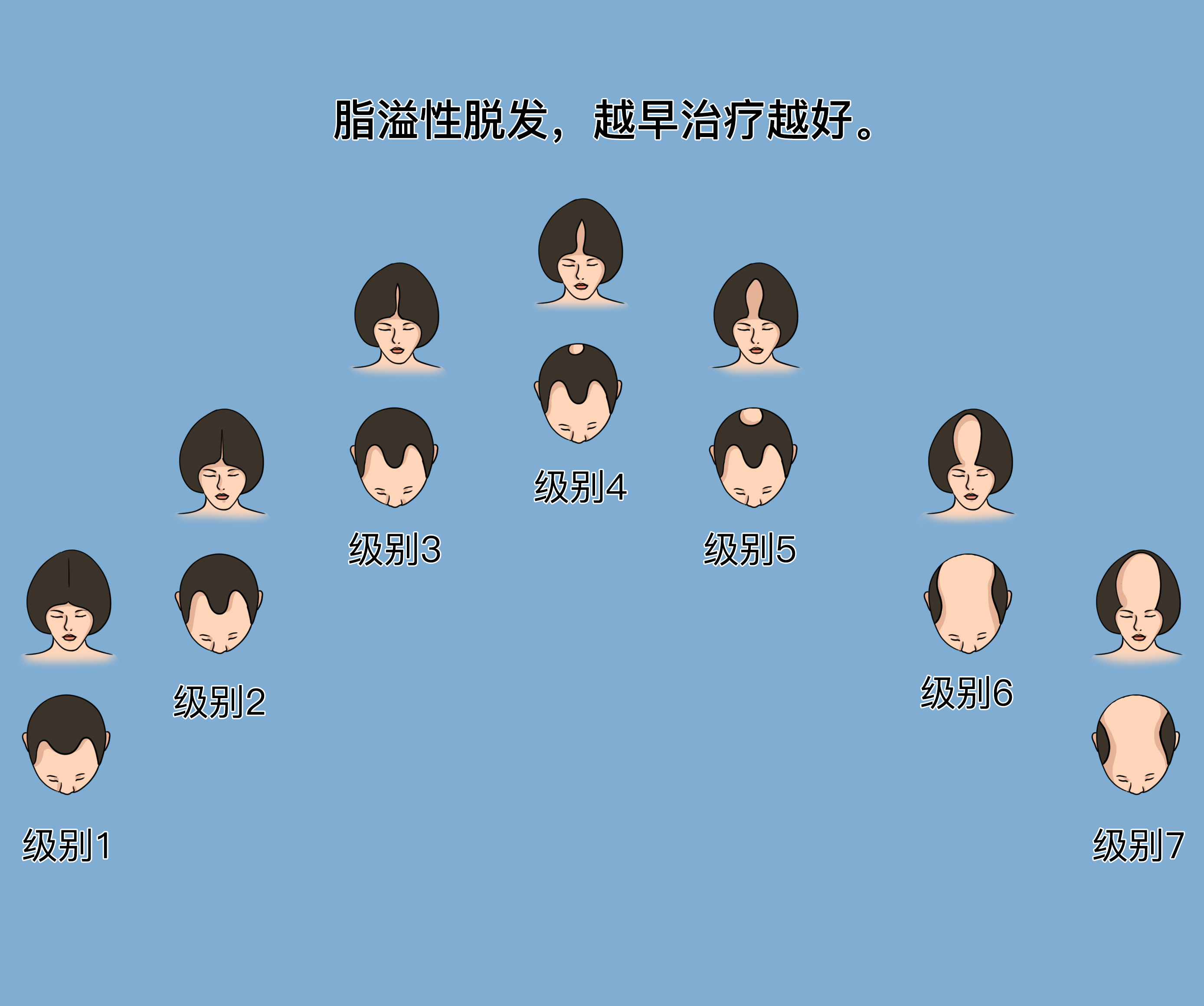 脂溢性脱发最佳治疗时间.jpg