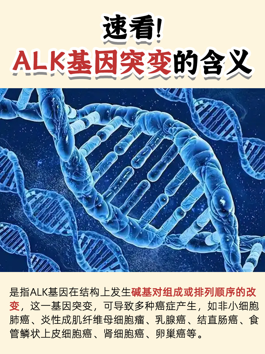 速看！ALK基因突变的含义