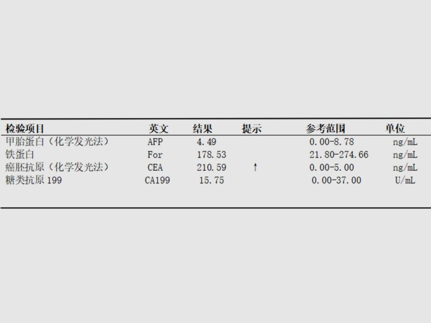 肺鳞癌（中年大叔确诊肺鳞癌，吸烟为主要病因）.png