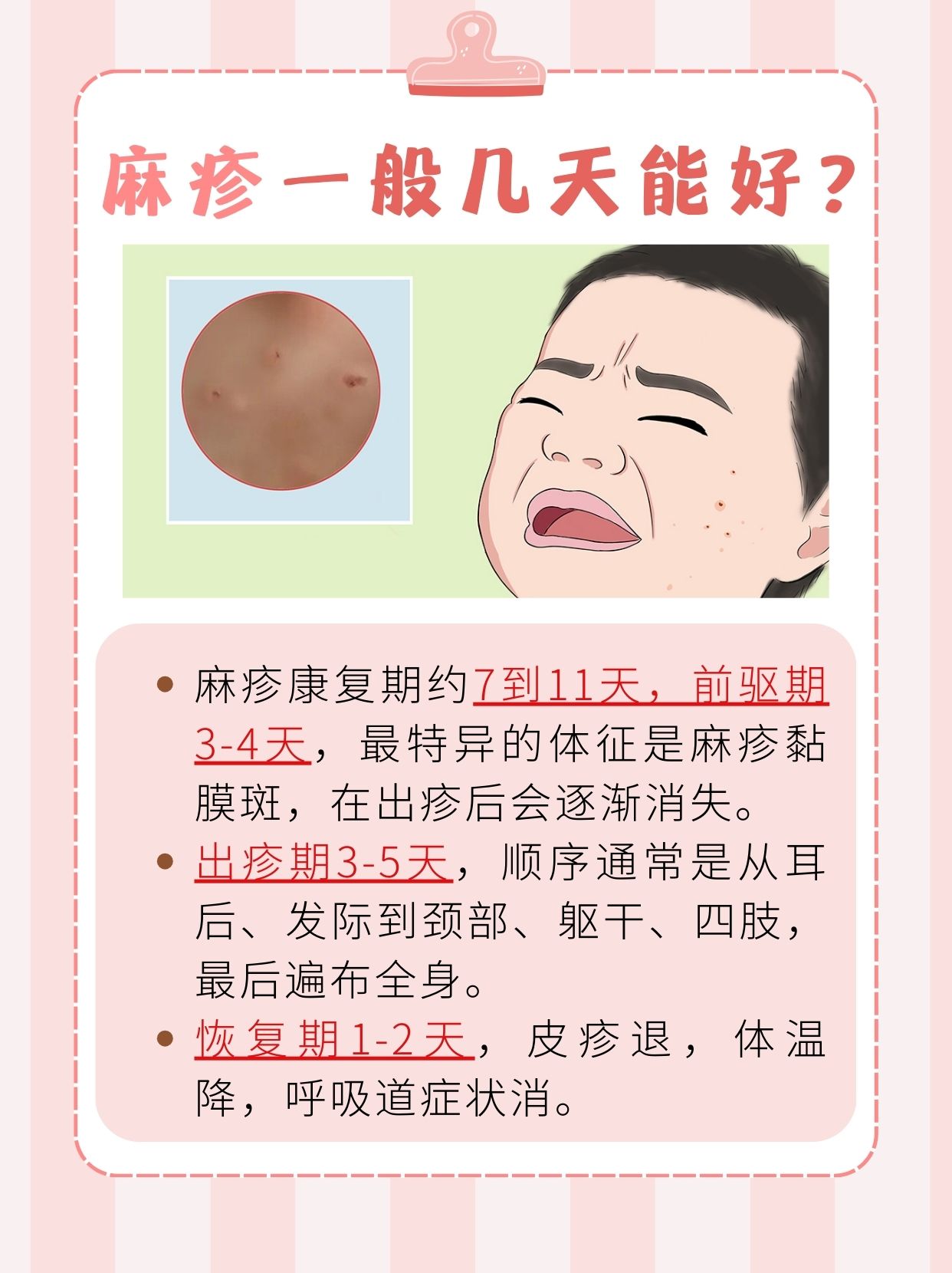 麻疹康复倒计时！几天能告别？