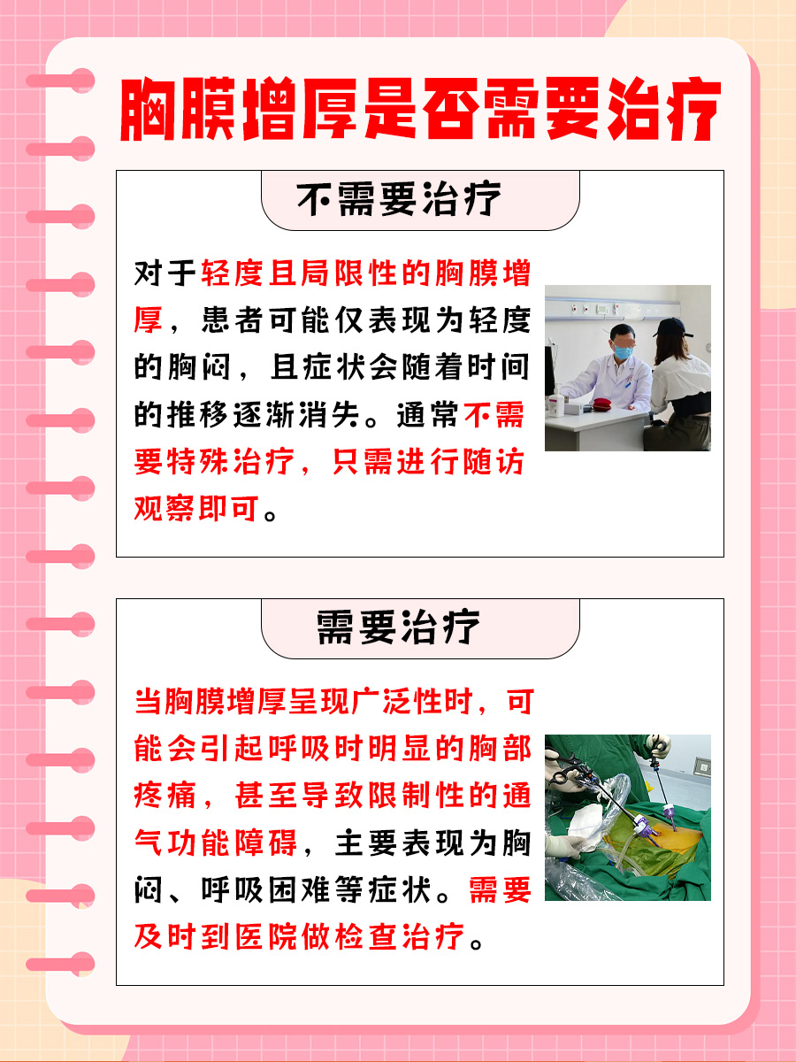 胸膜增厚需要治疗吗？答案在这里