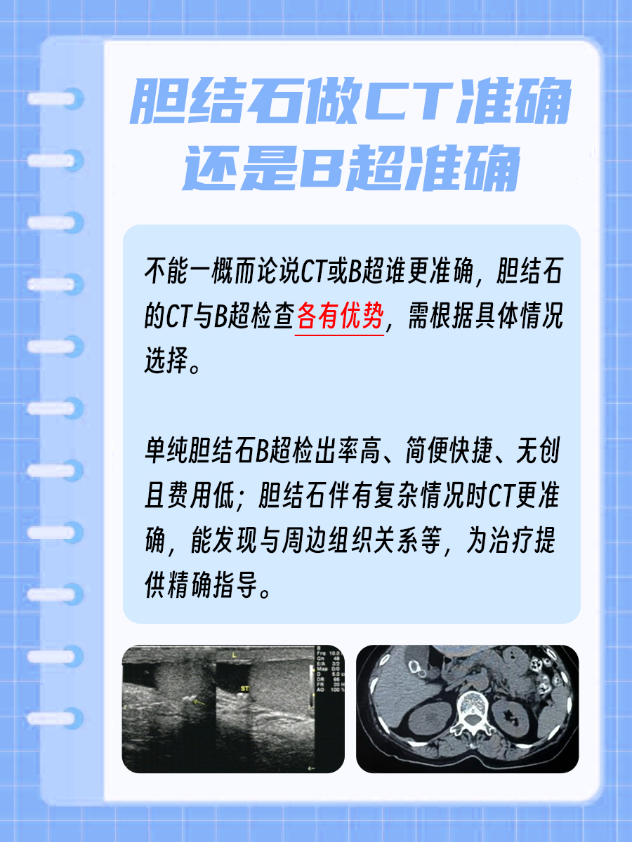 胆结石做CT准确还是B超准确,一看便知