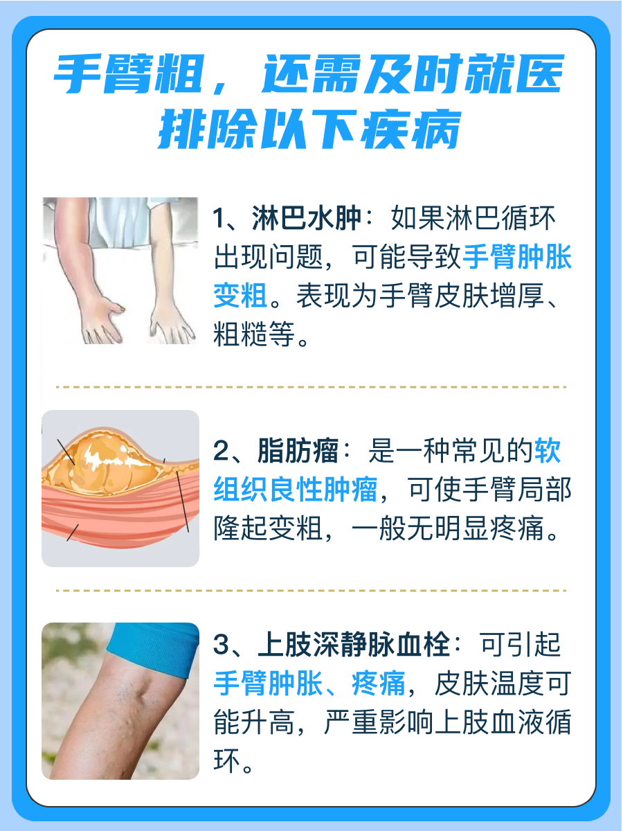 手臂粗是什么原因造成的，你知道吗？