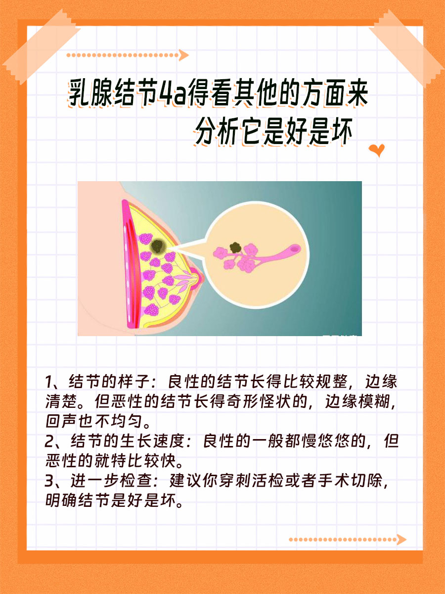 乳腺结节4a是良性还是恶性，看这篇就够了