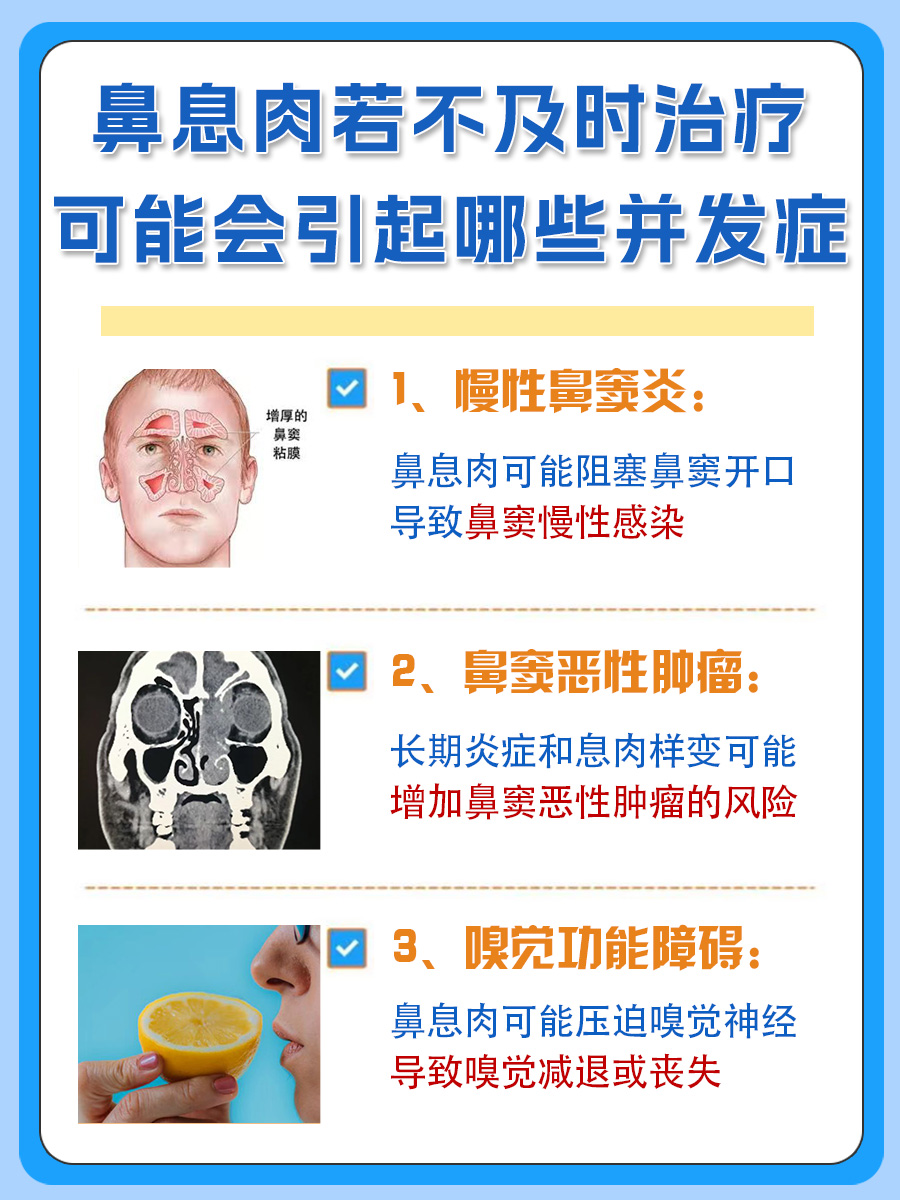 鼻息肉自查方法，你中招了吗？