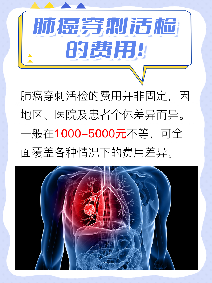 肺癌穿刺活检费用揭晓：至少上千！