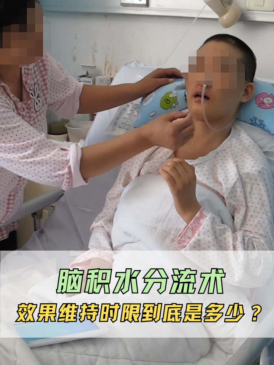 脑积水分流术,效果维持时限到底是多少?