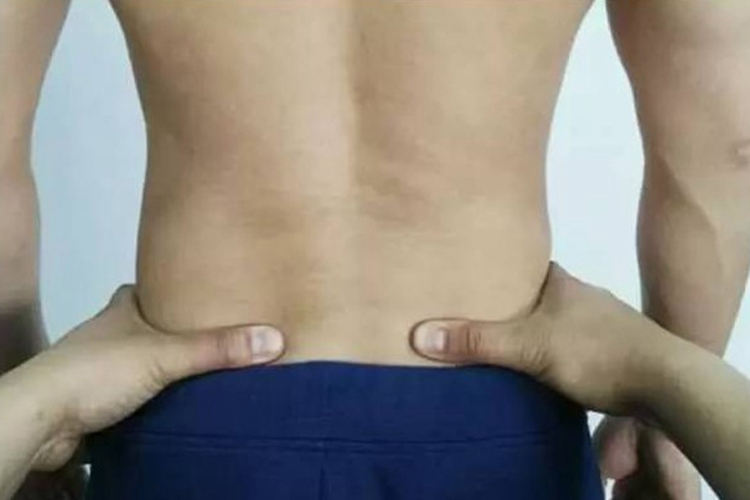 髂后上棘的真人位置图