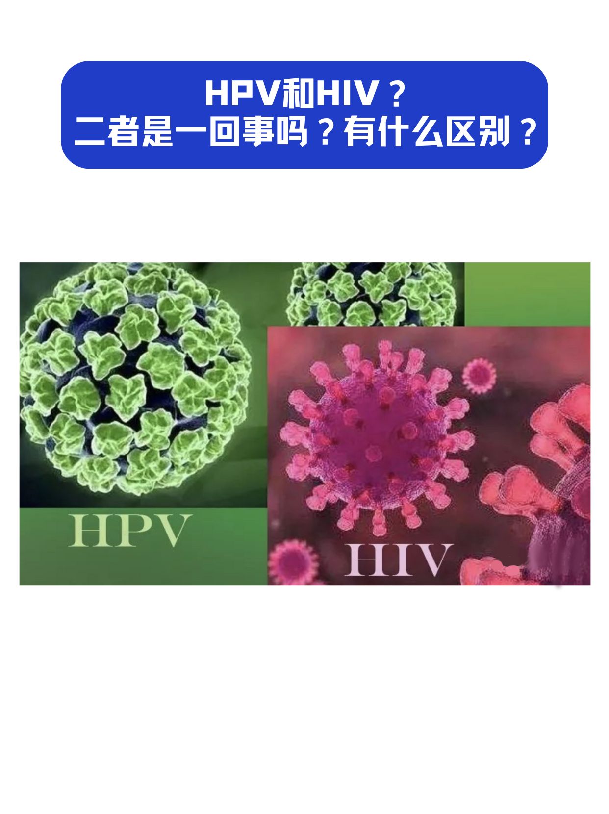 HPV和HIV有什么区别？二者是一回事吗