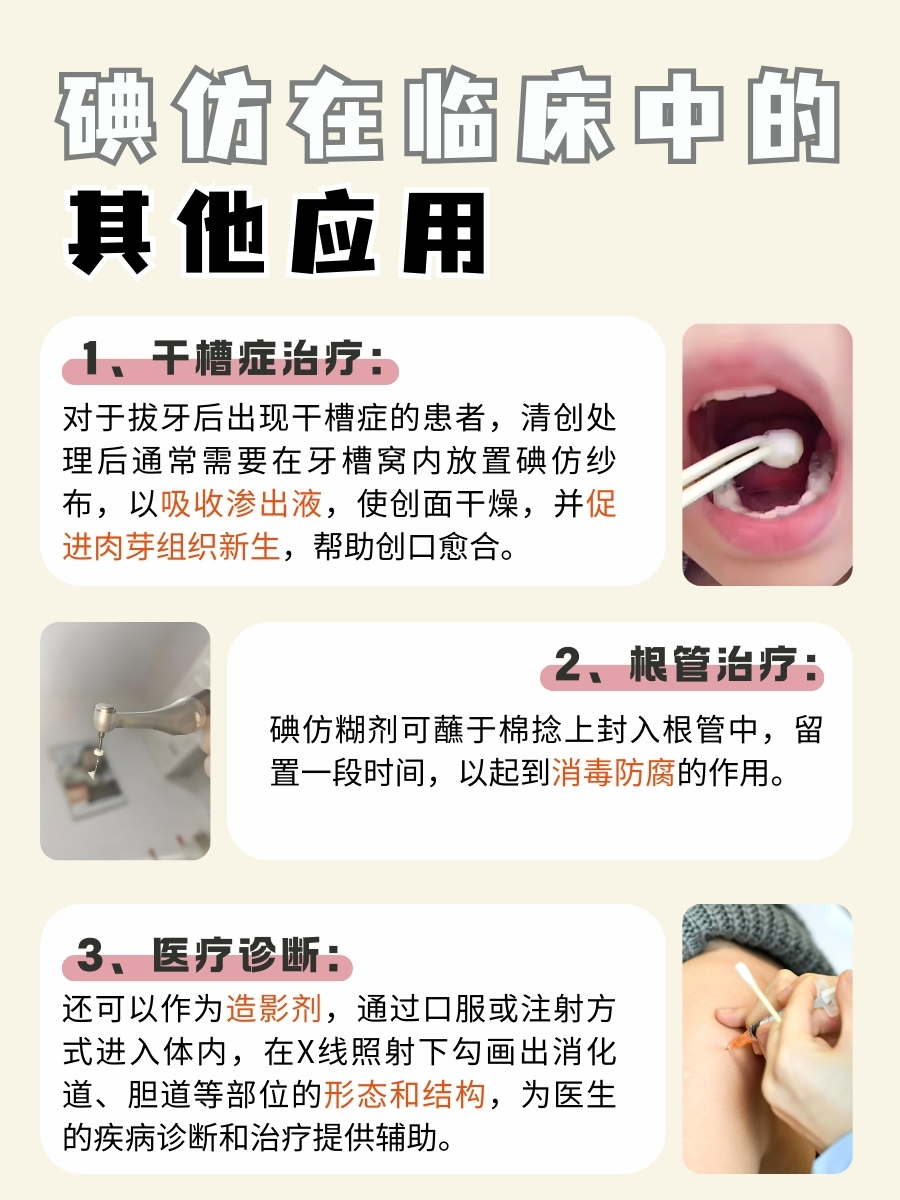 碘仿放进牙槽窝,几天能吸收完?答案来了!