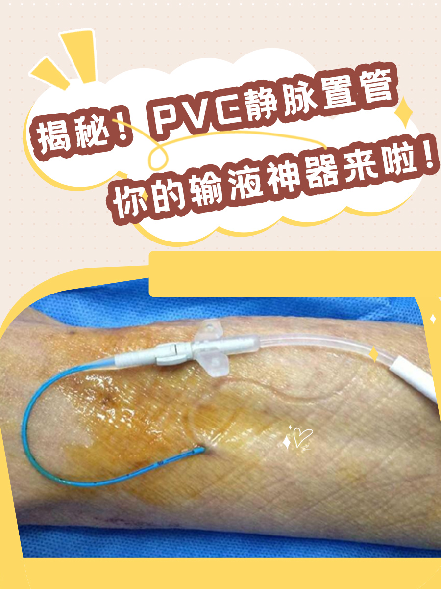揭秘!PVC静脉置管,你的输液神器来啦!
