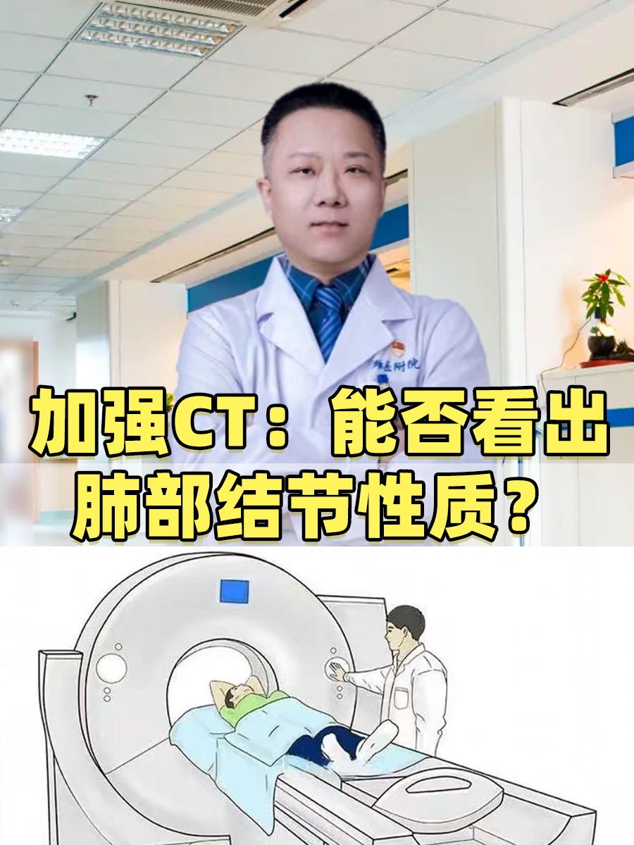 加强CT:能否看出肺部结节性质?