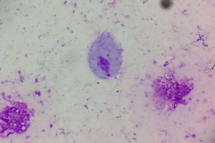 刘氏染色滴虫图