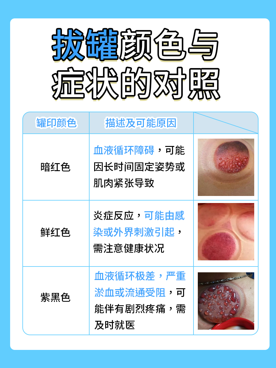 拔罐颜色症状对照表
