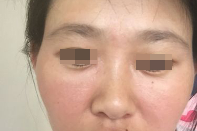 经前期综合征图