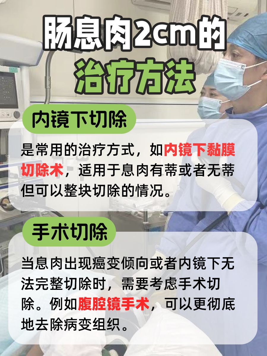 肠息肉2.0cm严重吗？为何不可轻视？