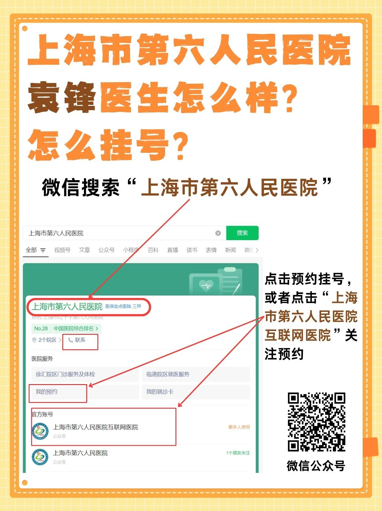 上海市第六人民医院袁锋医生怎么样？怎么挂号？