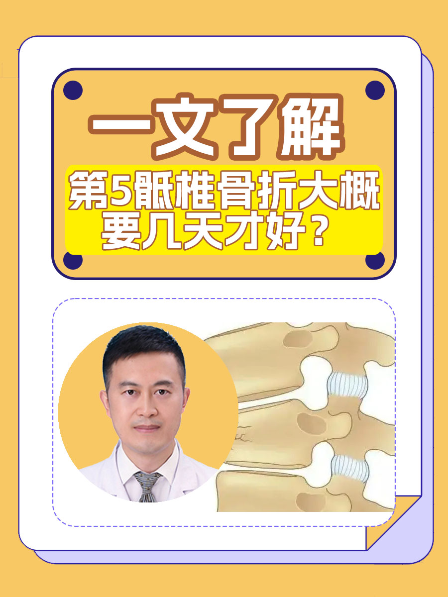 第5骶椎骨折大概要几天才好？一文了解