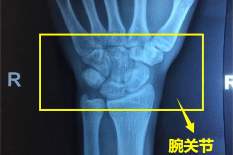 腕关节图