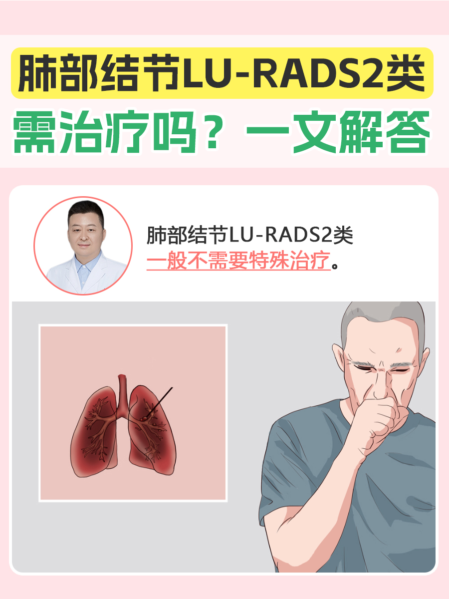 肺部结节LU-RADS2类需治疗吗？一文解答