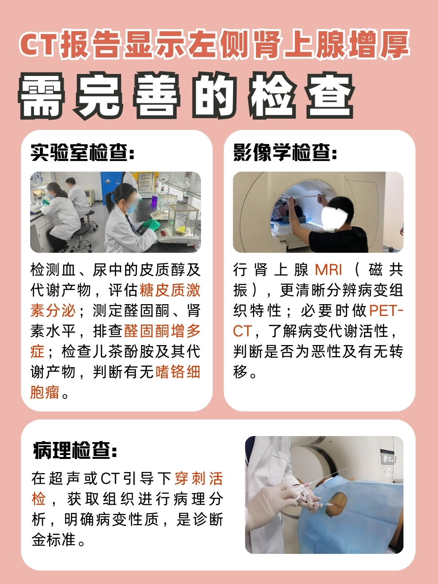 CT报告左侧肾上腺增厚正不正常，点这里了解！