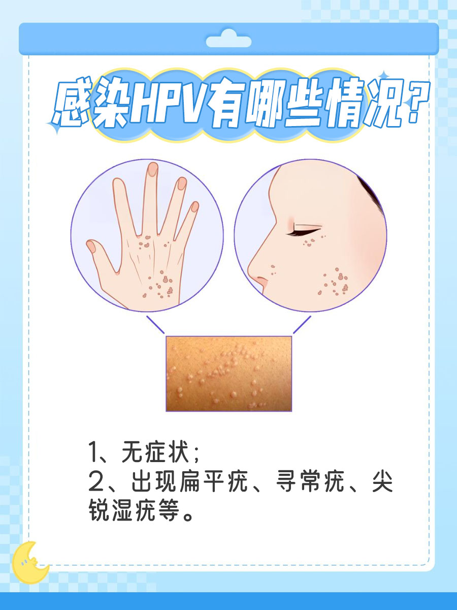 纯中药战HPV，老中医有妙招！