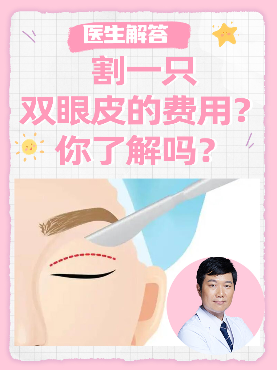 医生解答：割一只双眼皮的费用？你了解吗？