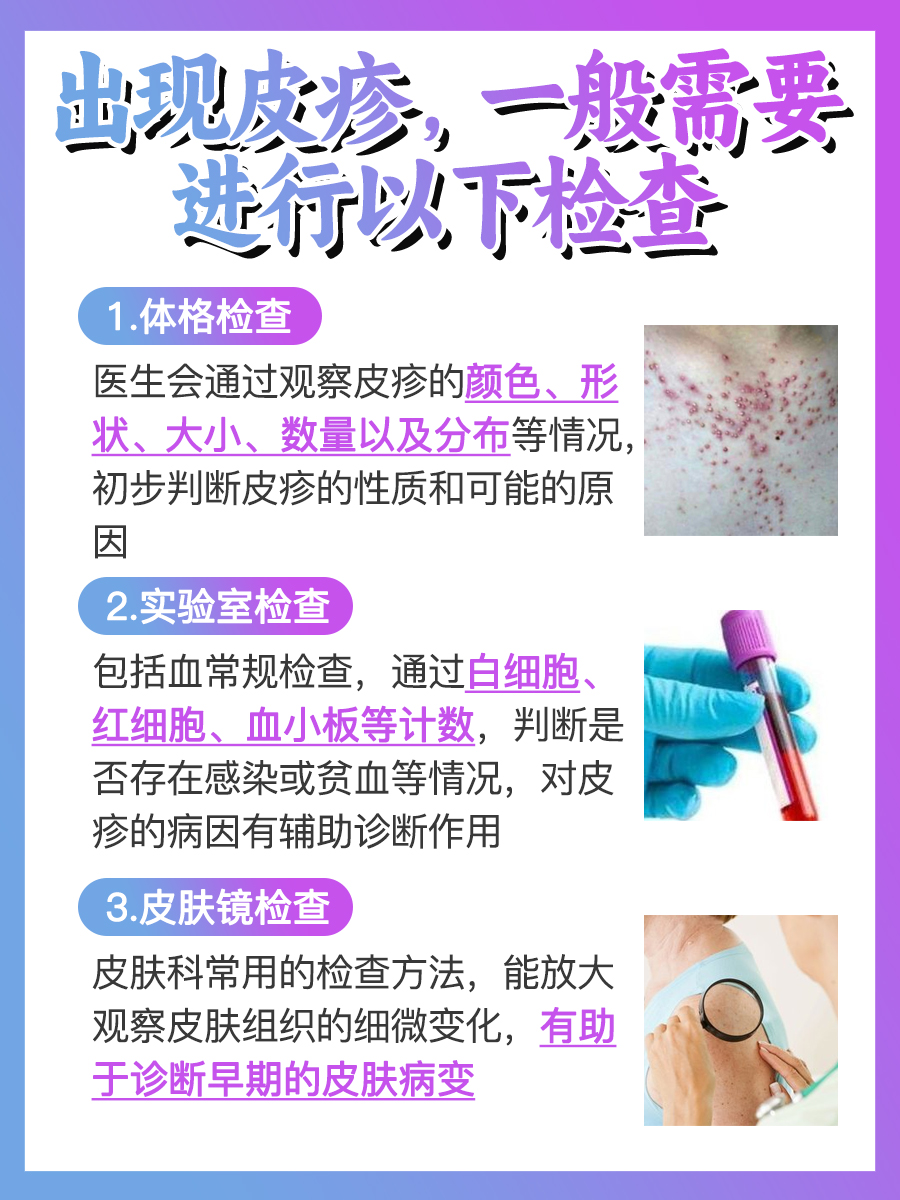 十个恐艾九个皮疹？听听医生怎么说