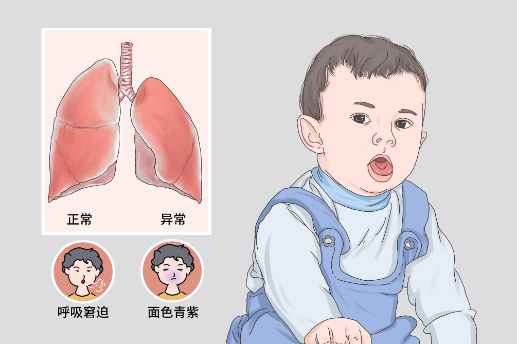 新生儿卡通肺部图片图片