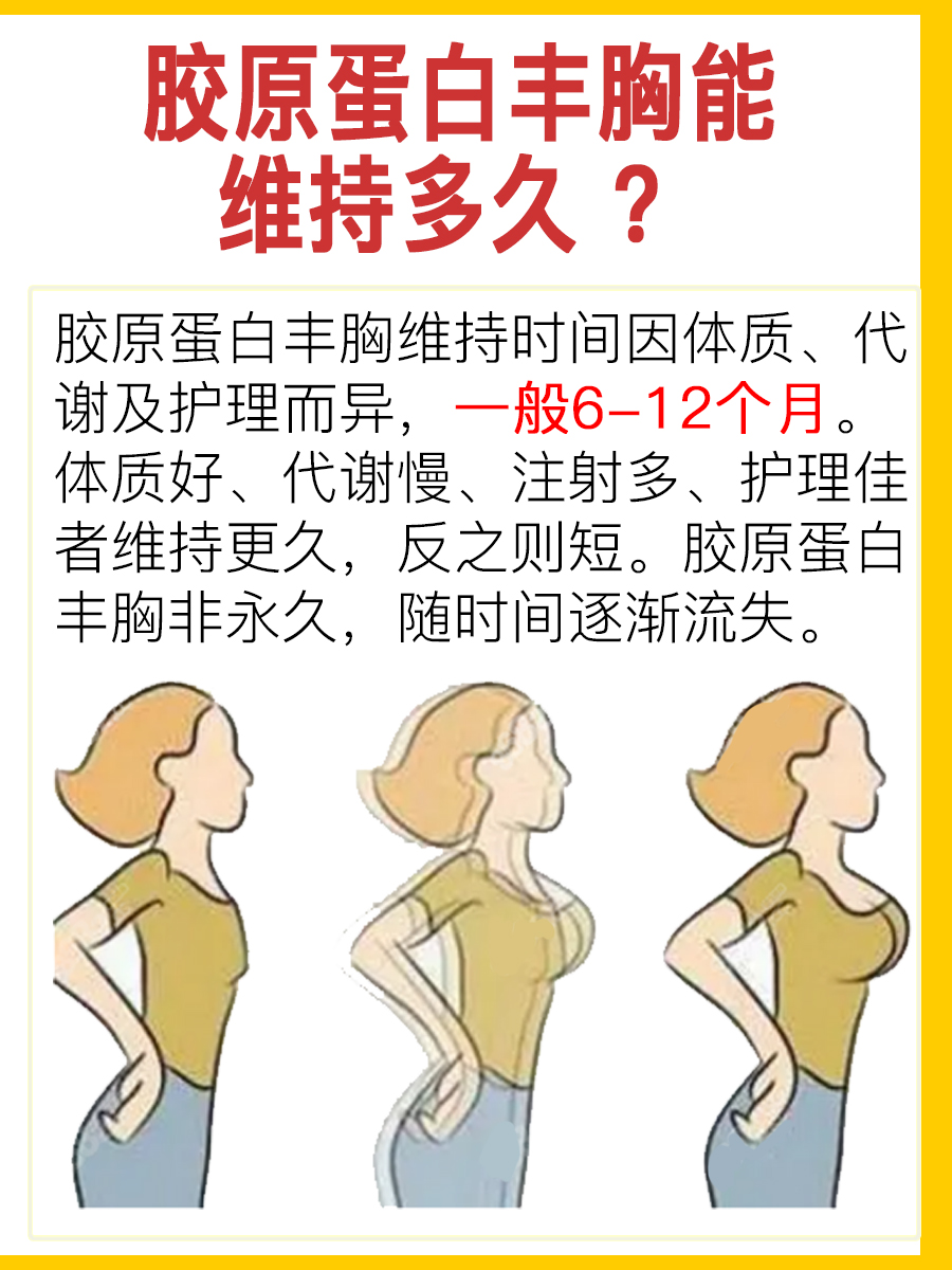 胶原蛋白丰胸能维持多久 ，答案揭晓
