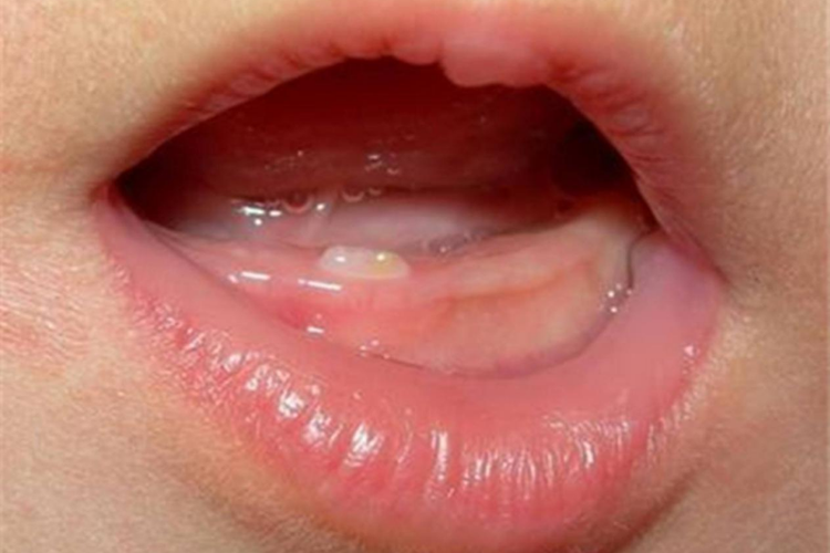 婴儿长牙初期图 婴儿长牙初期图