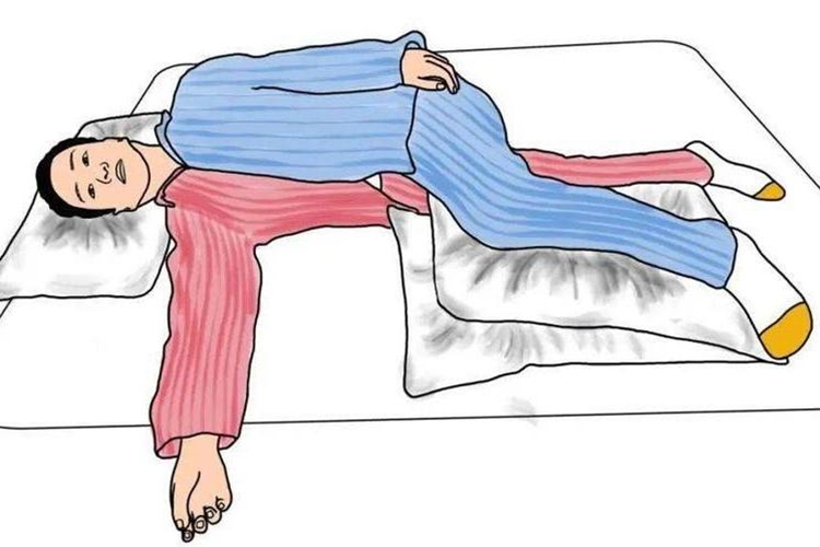 偏瘫患者患侧卧位图 偏瘫患者患侧卧位图