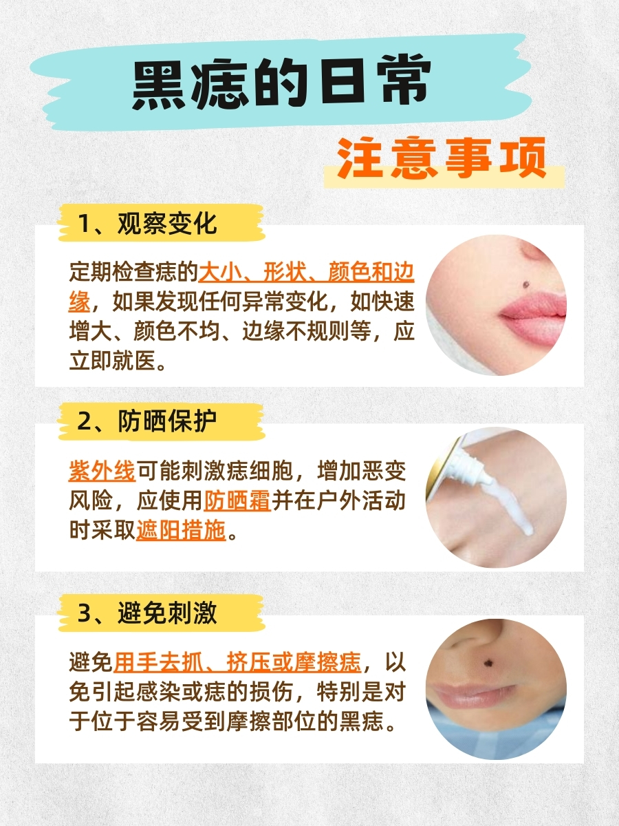 医生解答：嘴角上的黑痣该不该去掉