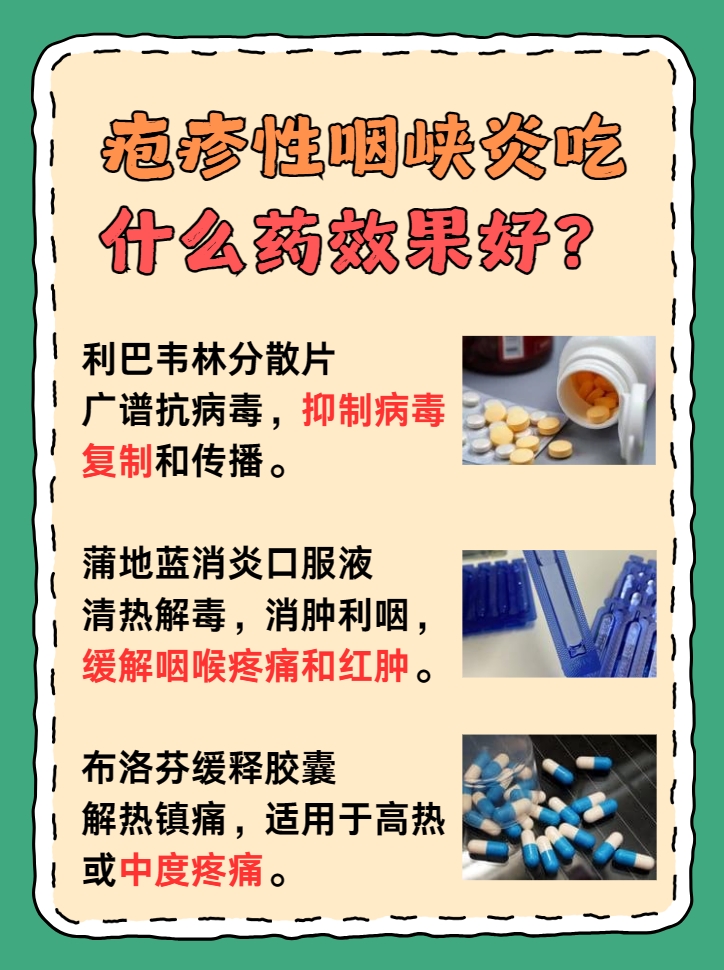 疱疹性咽峡炎吃什么药效果好，一文解析