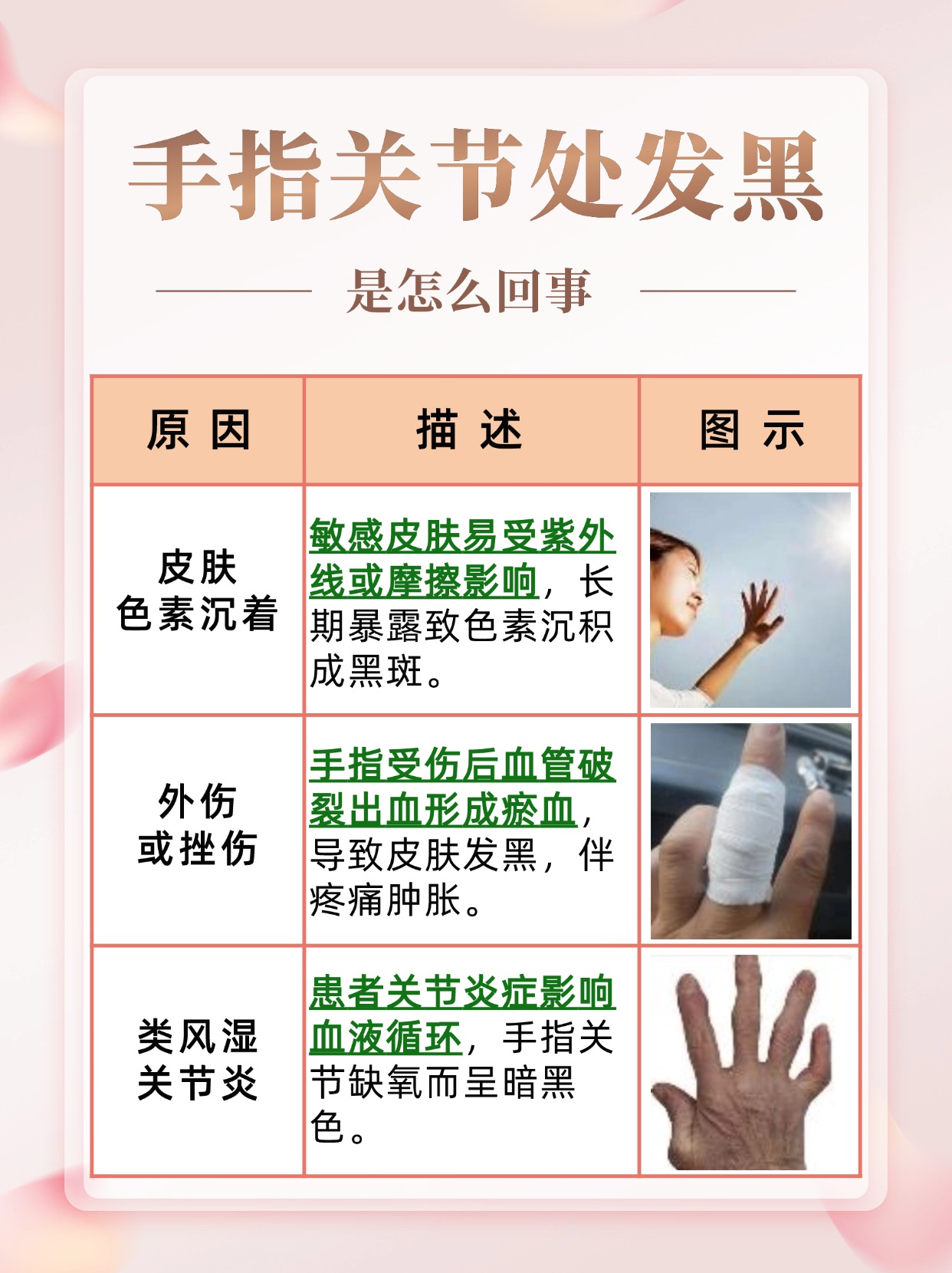 手指关节处发黑是怎么回事 ？带你读懂