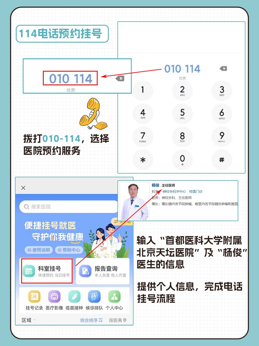北京天坛医院杨俊医生怎么样？怎么挂号？
