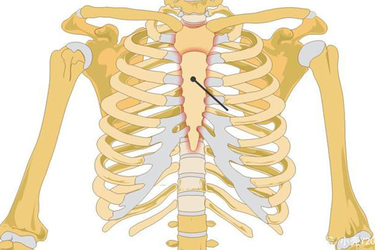 胸骨后疼痛位置示意图