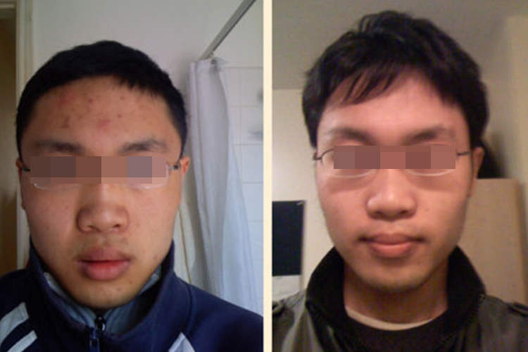 吃素皮肤前后对比图