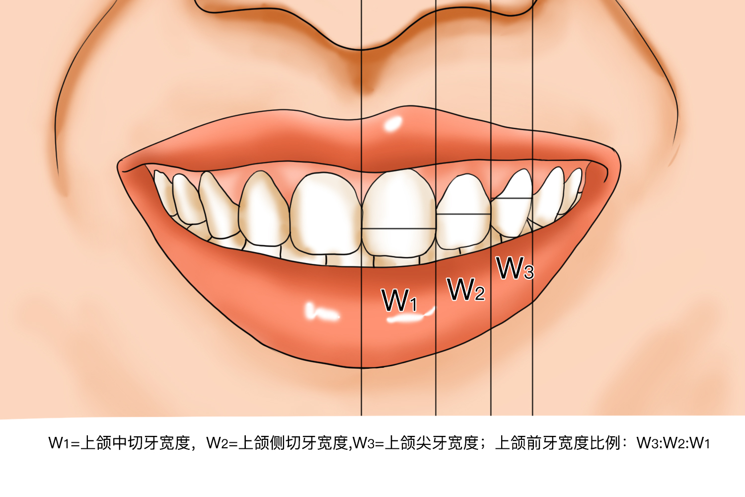 牙齿宽度示意图 牙齿宽度示意图