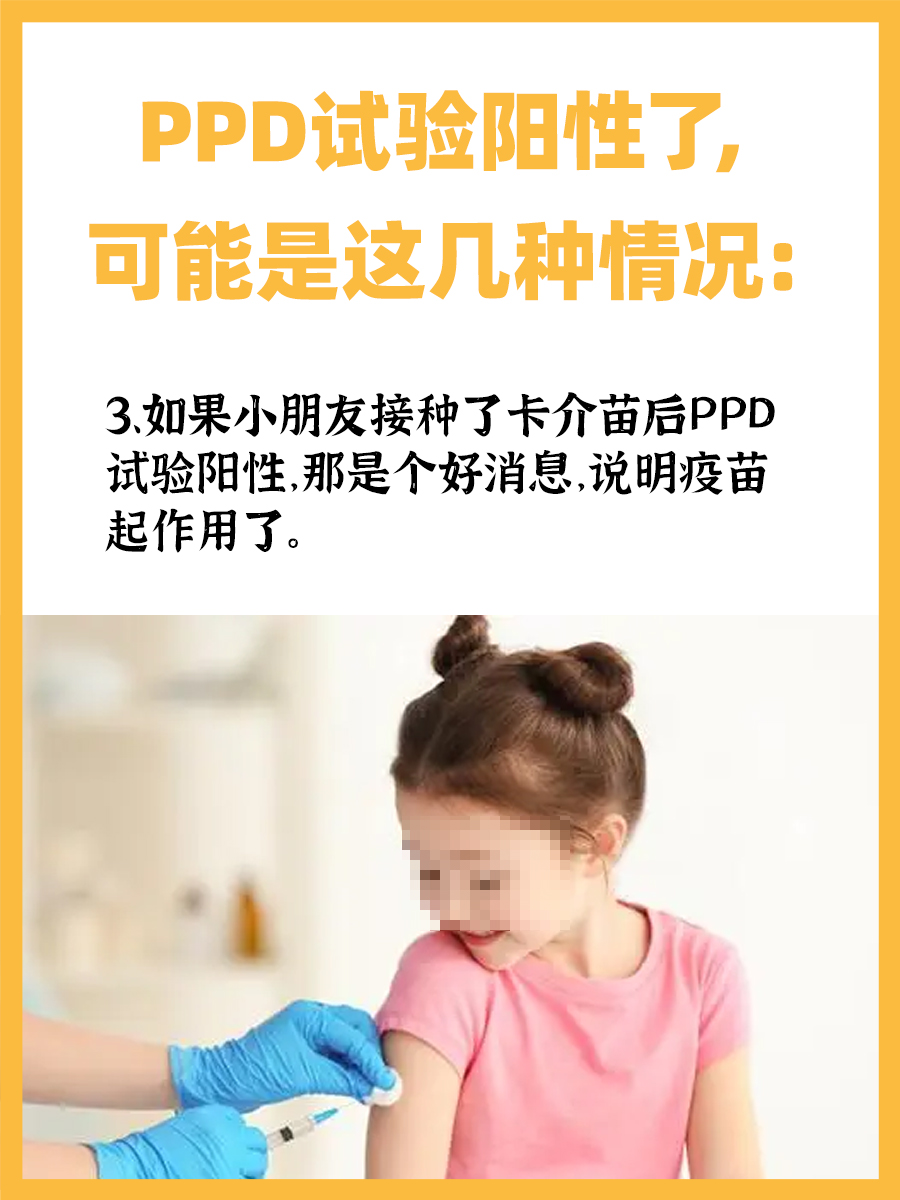 速戳！PPD红肿凸起来就是硬结吗？