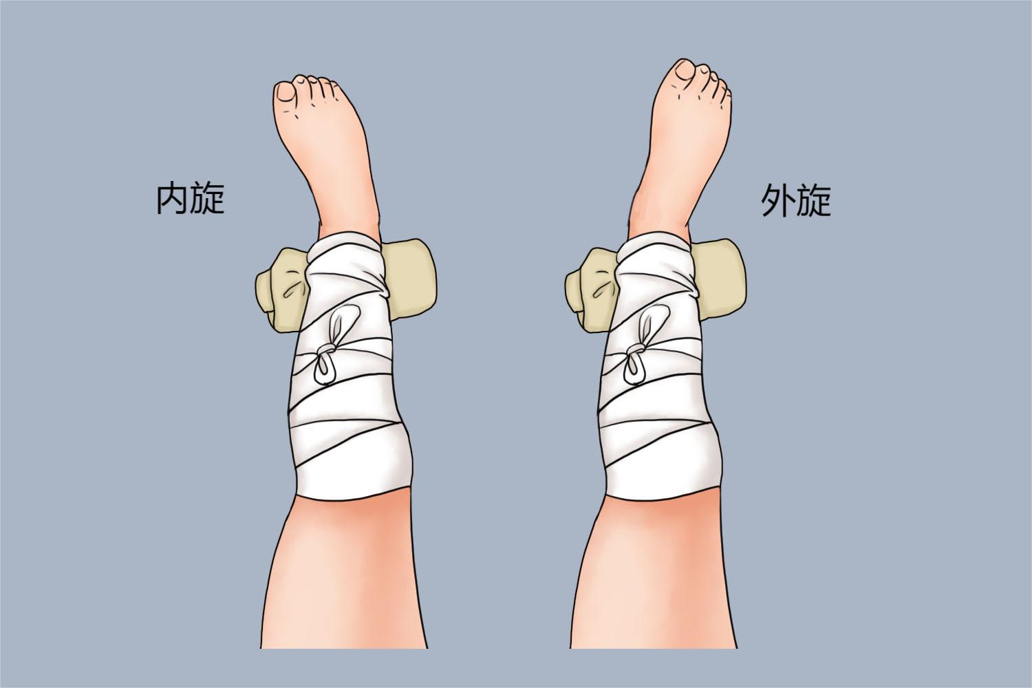 小腿骨折错误睡姿图