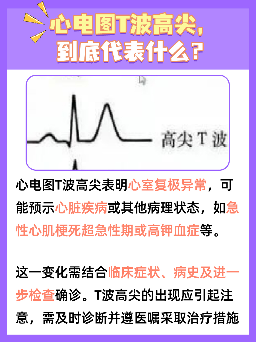 心电图T波高尖，你知道代表着什么吗？
