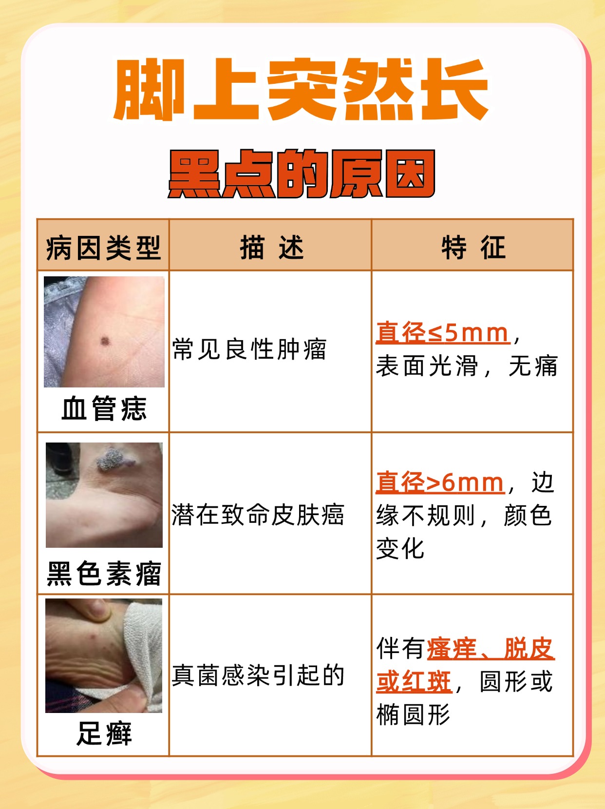 警惕！脚上突发黑点，可能是这些问题！