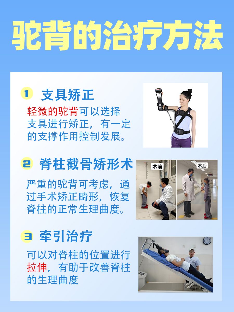 驼背矫正带真的有用吗？答案揭晓