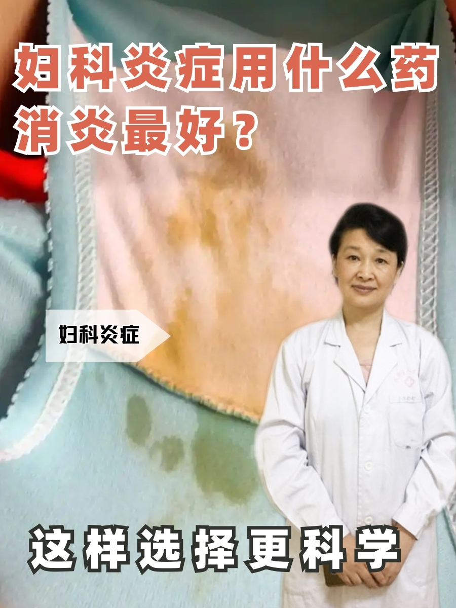 妇科炎症用什么药消炎最好？这样选择更科学