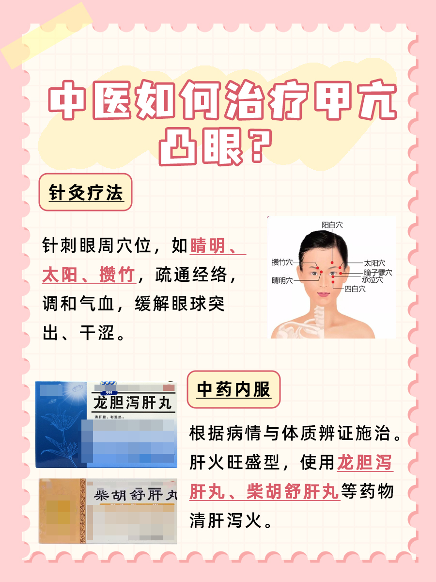 甲亢凸眼中医能治疗好吗，医生解析