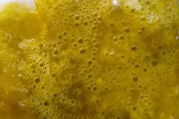 黄色稀水样便图