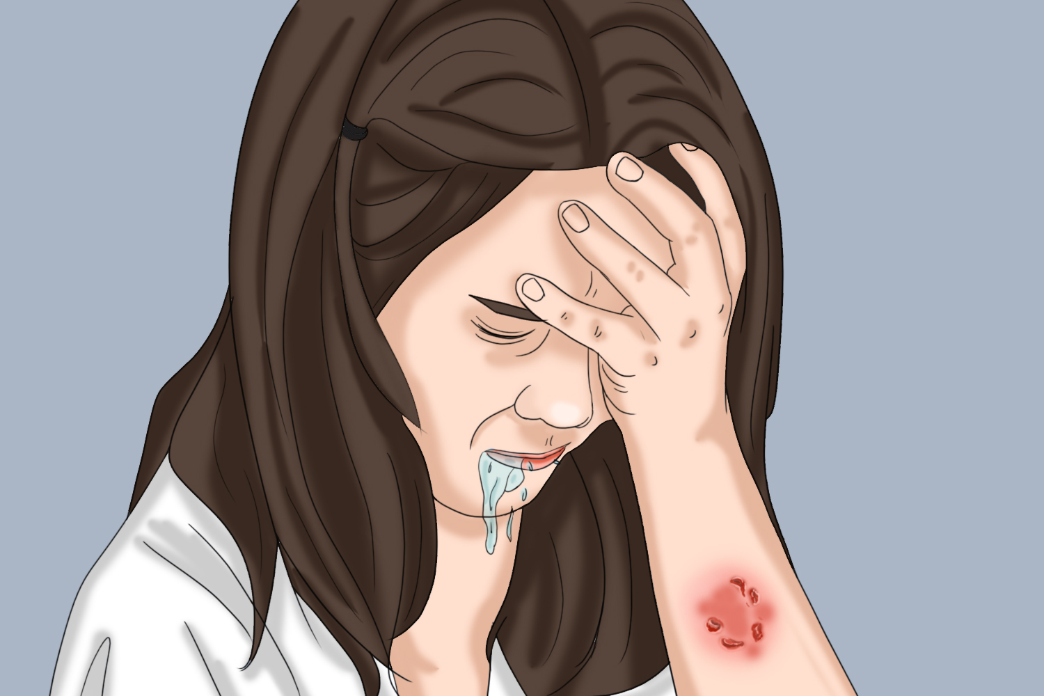 前驱期发作图 前驱期发作图